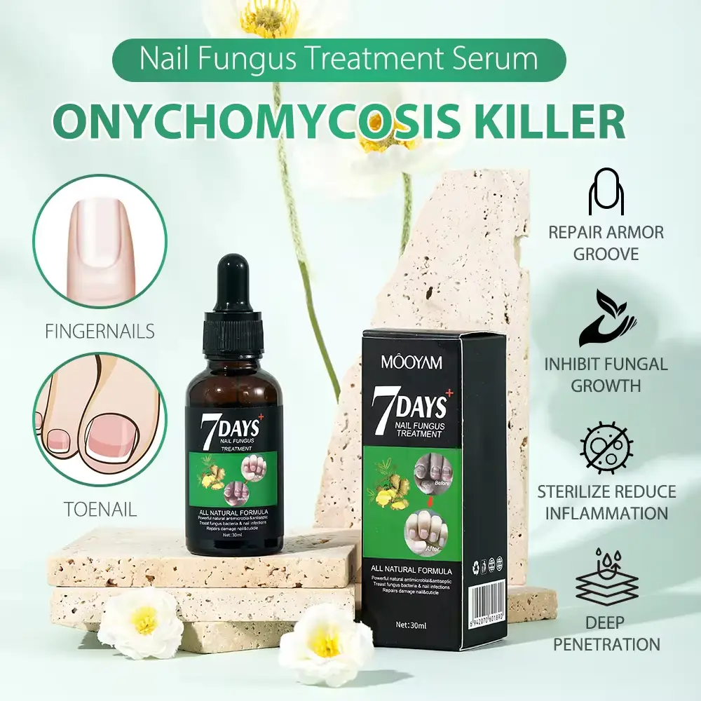 Best Nail Fungus Serum Price in Pakistan – 7 Day Treatment (30ml)