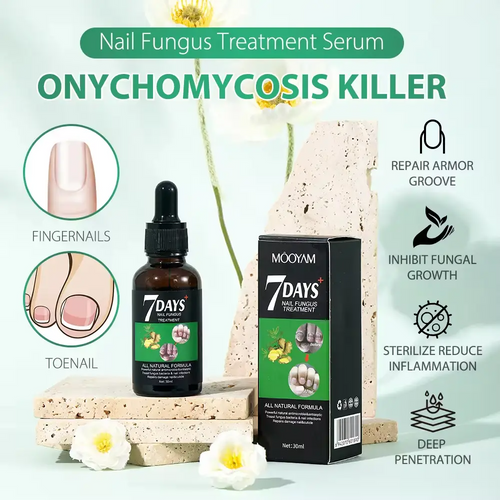 Best Nail Fungus Serum Price in Pakistan – 7 Day Treatment (30ml)