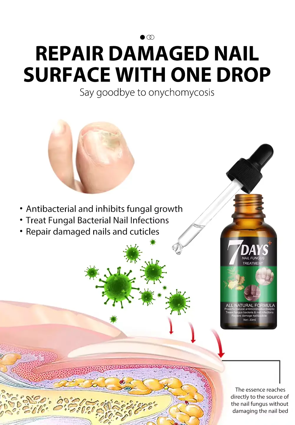 Best Nail Fungus Serum Price in Pakistan – 7 Day Treatment (30ml)